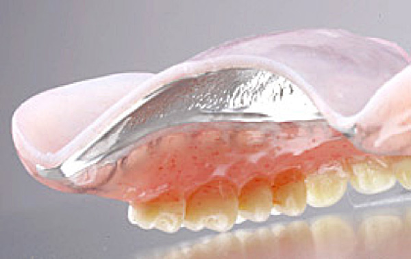 国立の歯医者、国立深澤歯科クリニックの義歯