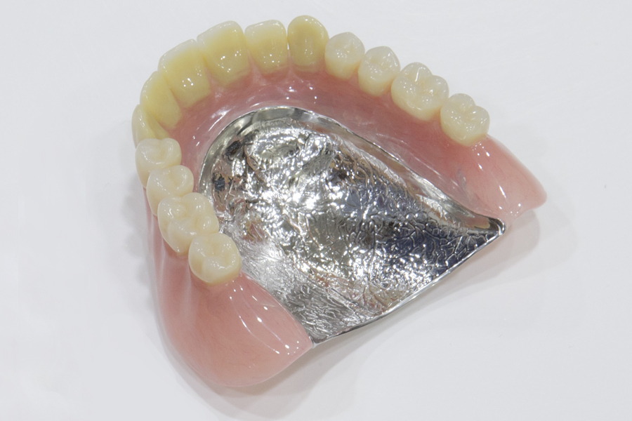 国立の歯医者、国立深澤歯科クリニックの義歯