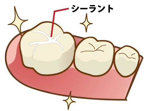 国立の歯医者、国立深澤歯科クリニックの小児歯科