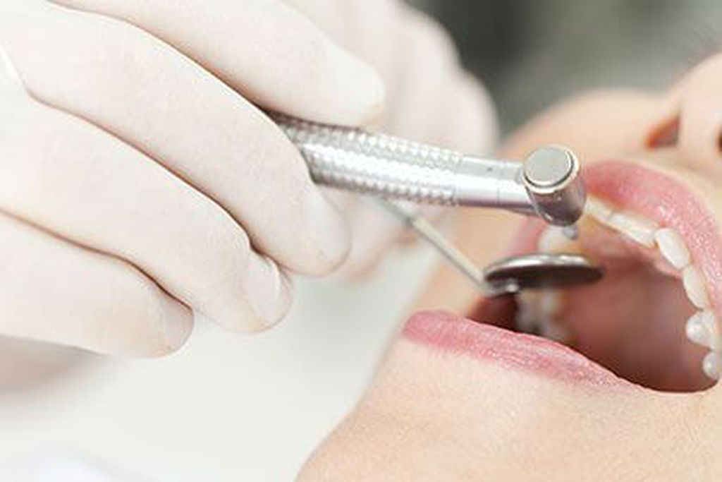 国立の歯医者、国立深澤歯科クリニックの予防歯科