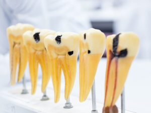 国立深澤歯科クリニックの歯ぐきがムズムズする原因の解説