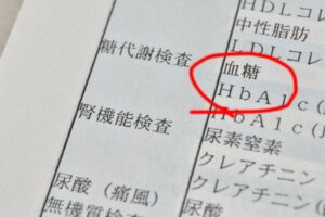国立駅徒歩3分の歯医者、国立深澤歯科クリニックで、根分岐部病変とは？奥歯特有の歯周病の治療法と予後を解説